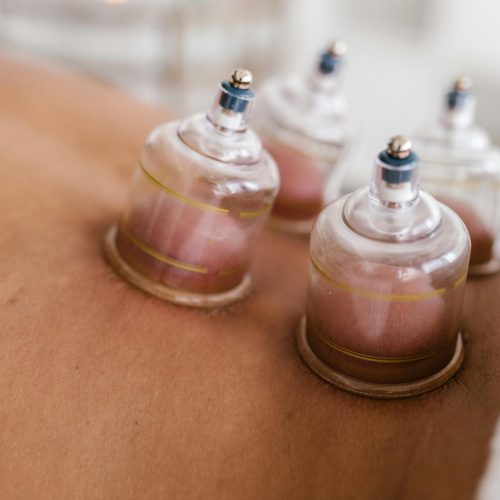 cupping